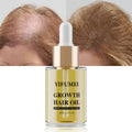 Private Label Men Women Ginger Treatment Anti Hair Loss Serum Oil Regrowth Care Caffeine Biotin Hair Growth Serum Oil