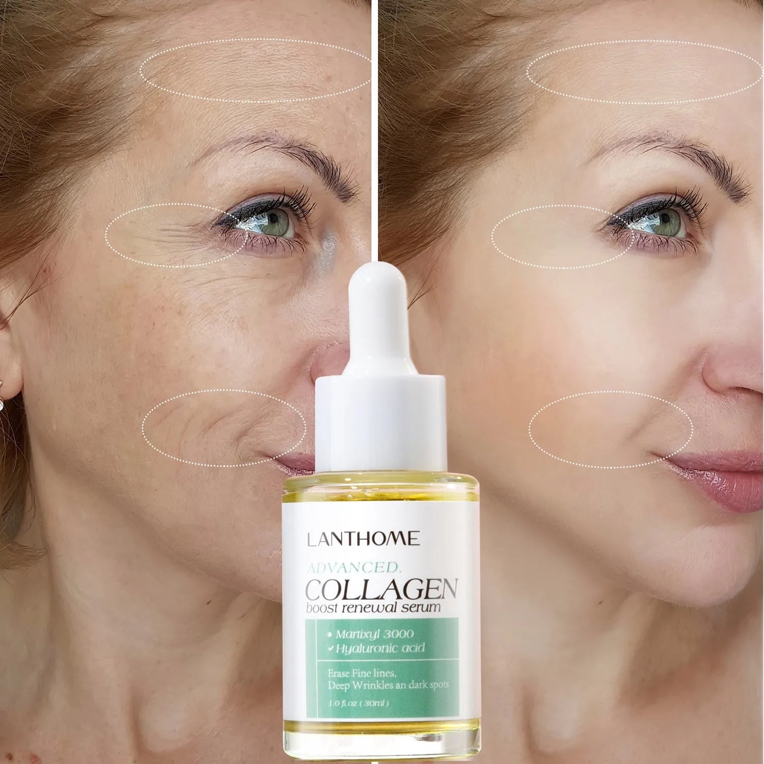 Hot Selling Lanthome Boosf Renewal Skin Moisturizing Nourishing Hyaluronic Acid Collagen Face Serum