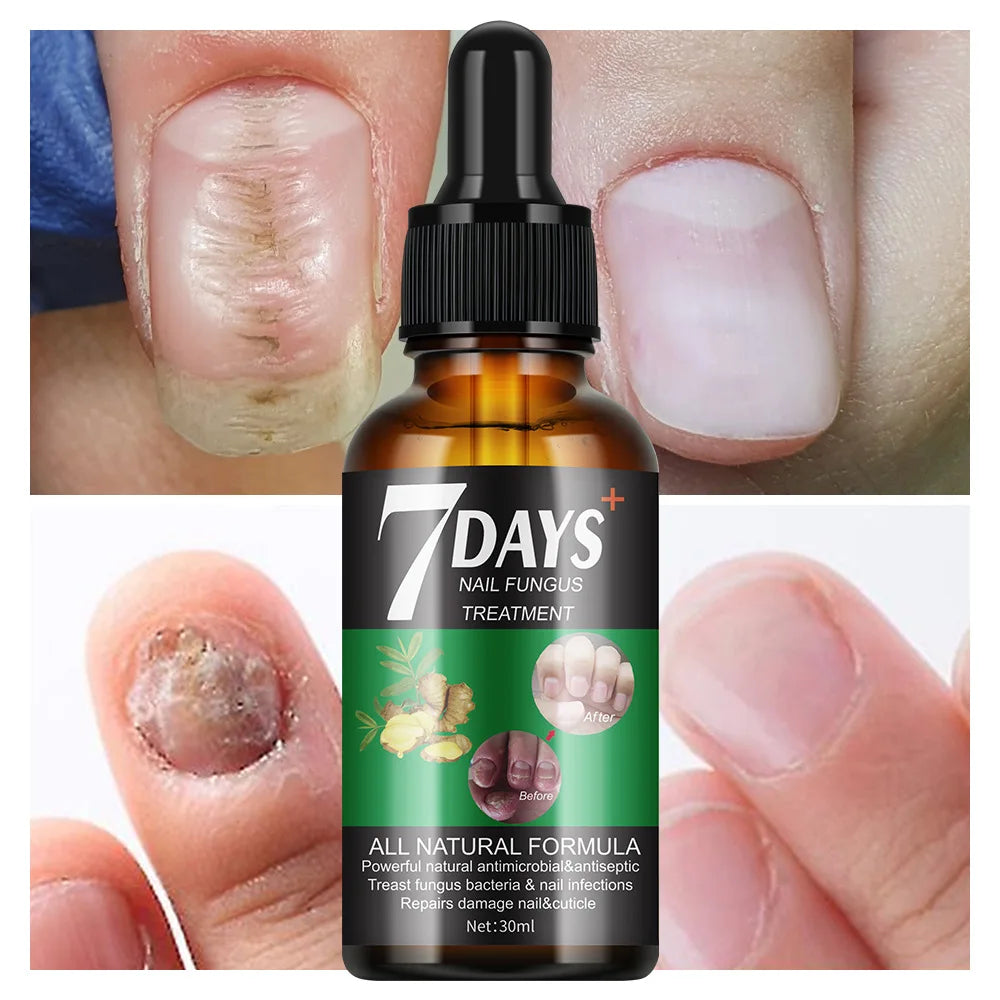 Organic Herba Nail Nourishing Solution Fast Nail Cleaning and Repair Nail Care in Stock Wholesale Price