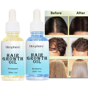 Private Label 30ml Scalp Nourish Hair Growth Oil Infused Argan Coconut Tea Tree Oils for Kids Hair-Loss Prevention