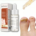 Fungal Nail Treatment Serum Foot Repair Liquid Care Whitening Toe Nail Fungus Removal Gel Anti Infection