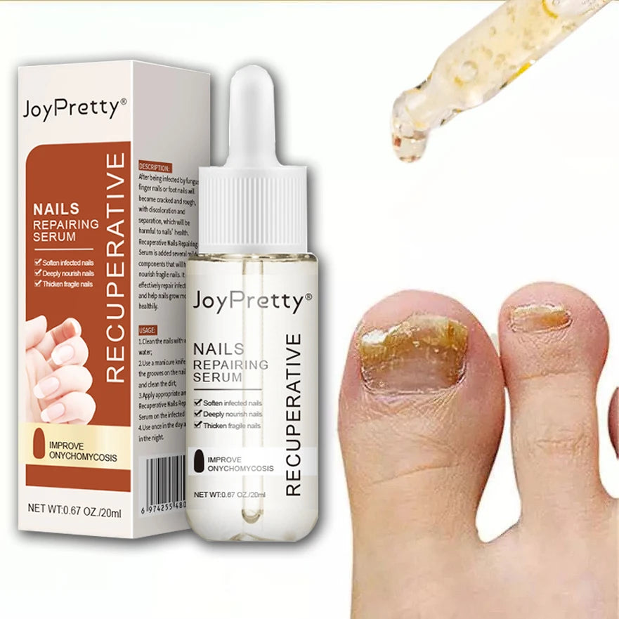 Fungal Nail Treatment Serum Foot Repair Liquid Care Whitening Toe Nail Fungus Removal Gel Anti Infection