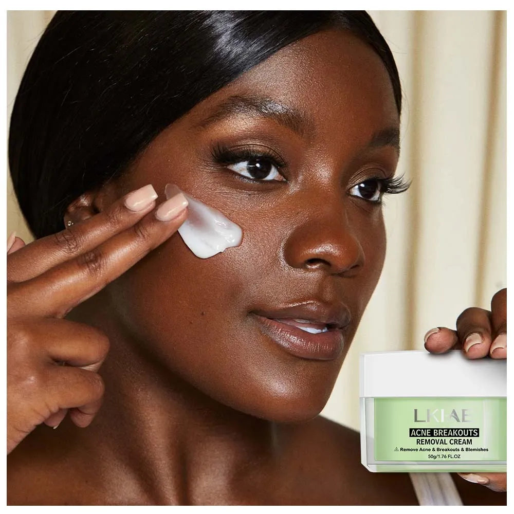 LKIAE Advanced Multiple Plant Extract Anti Acne Blackhead Remover Cream Acne Cream for Black Women
