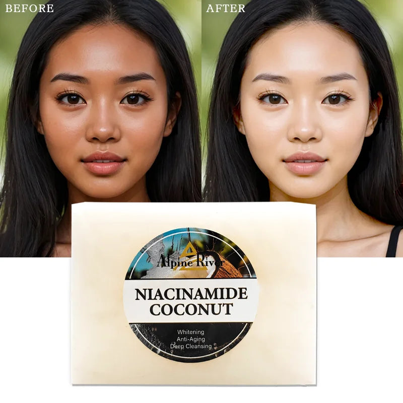 200g Niacinamide Handmade Soap Deep Cleansing Oil Control Face Soap Whitening Anti-Aging Skin Care Coconut Soap