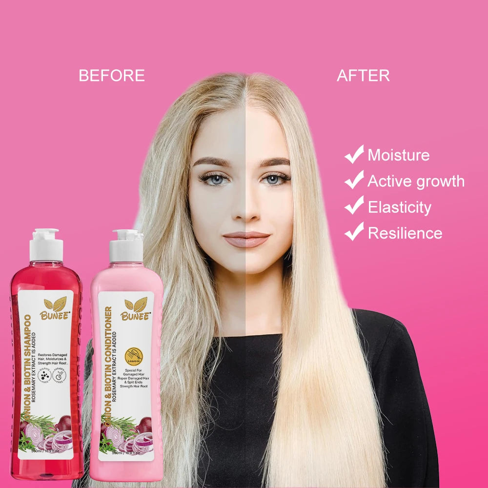 New Arrival Red Onion Hair Growth Shampoo Set Oem Odm Anti Hair Loss Onion Shampoo Fluffy Features