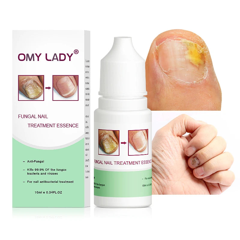 Private Label Nail Repair Essence Fungal Nail Treatment
