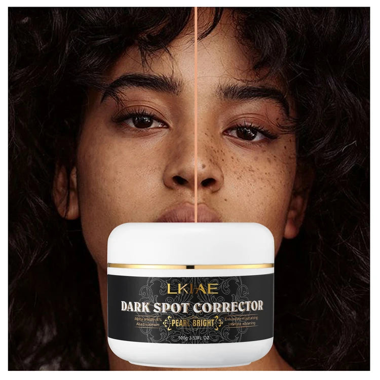 Private Label Fast Extreme Whitening Knuckle Cream Organic Arbutin Strong Remove Dark Spots Face Cream