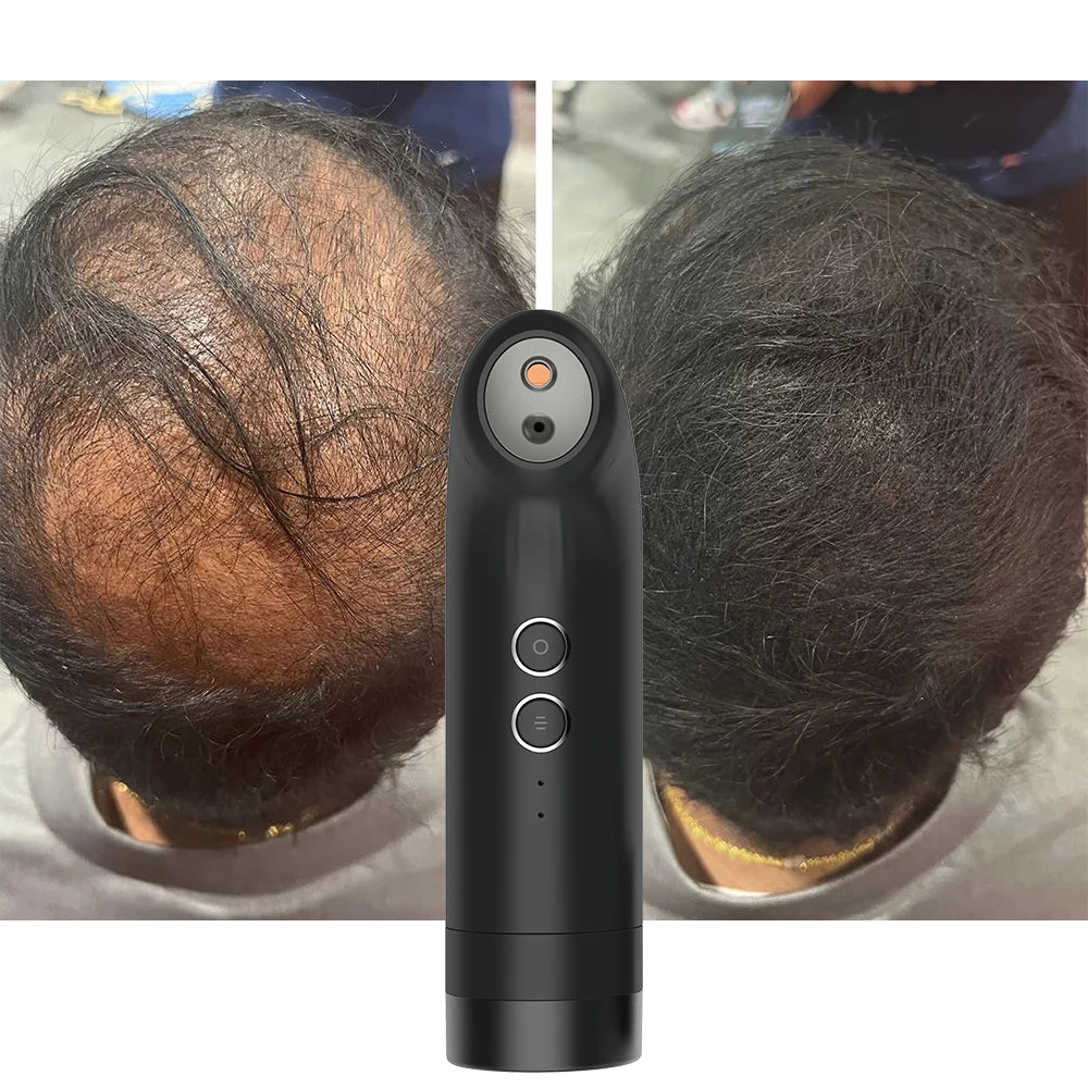 Spot Product Hair Building Fibers Keratin Powder Electric Spray Applicator White Color Removers Hair Loss Treatment Hair Fiber