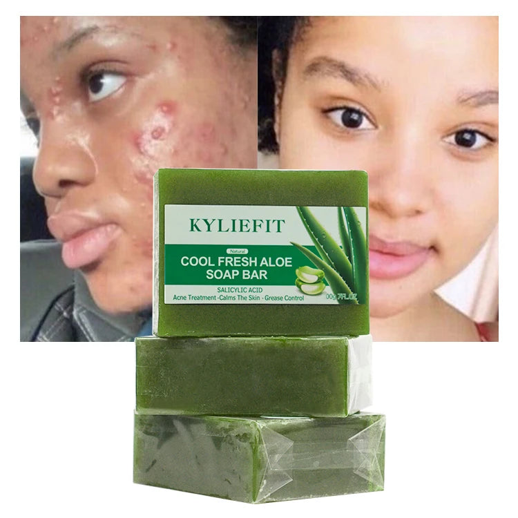 100g Private Label Aloe Vera Soap Custom Organic Herbal Anti Acne Soothing Facial Whitening Aloe Vera Soap