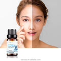 100% Pure Natural Blend Oil Skin Care Acne Lavender Lemon Peppermint for Sale in Several Essential Oils