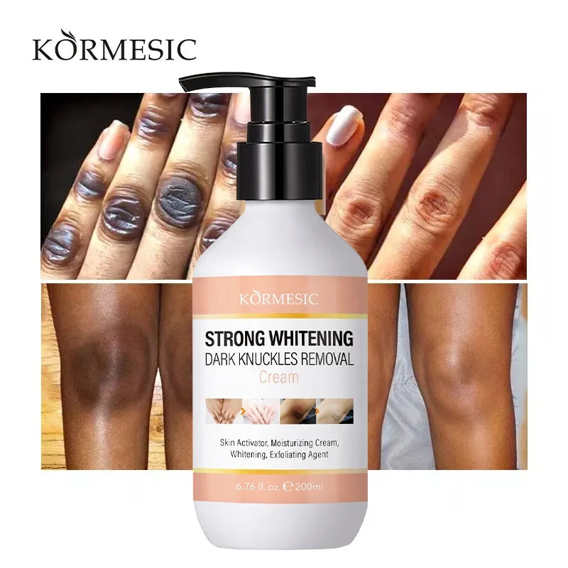 OEM KORMESIC Dark Knees and Elbows Knuckles Dark Spot Knuckles Eraser Underarm Elbows Armpit Strong Whitening Cream