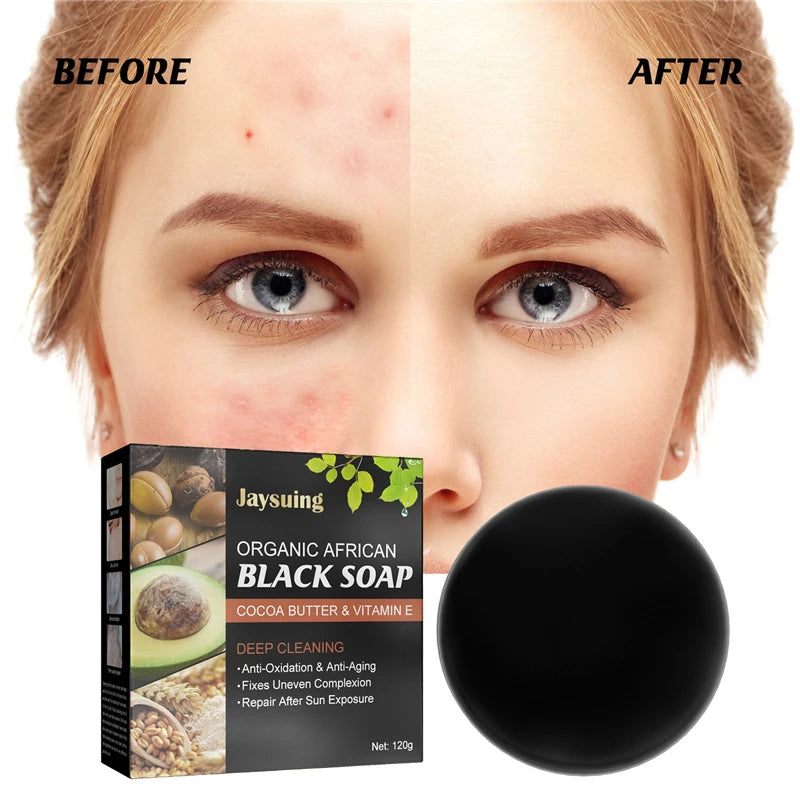 Jaysuing Natural African Black Soap Wholesale Acne Removing Anti Aging Skin Repairing Moroccan Black Soap with Argan Oil