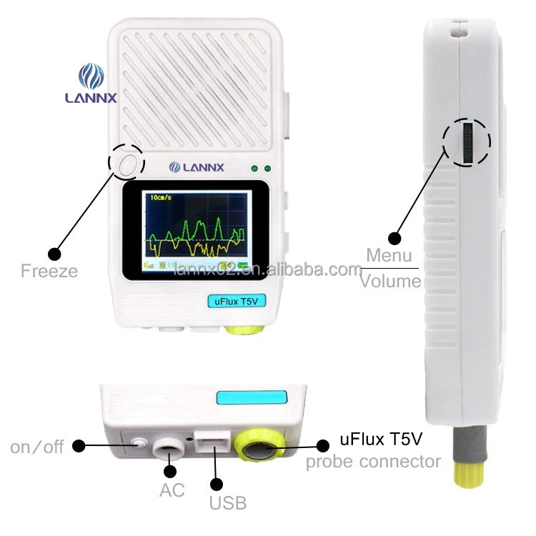 LANNX UFlux T5V Highest Cost-effective Doppler Blood Flow Detector Detect Blood Flow in Humans Animals USG Blood Flow Detector