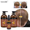 For Istennok 100% Pure Natural Grade Rosemary Essential Oil Hair Growth Shampoo Conditioner Contains Ginger Coconut Oil for Hair
