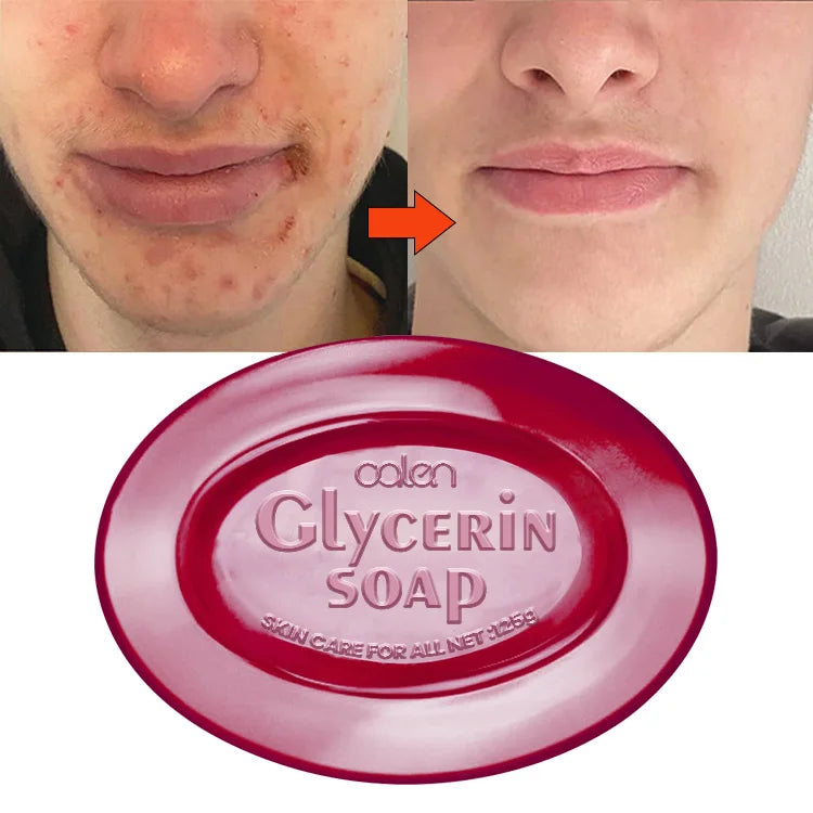 Luxfume Customs Logo 125G Vegan Transparent Herbal Nourishing Gel Cleansing Soap for Normal Skin Daily Use