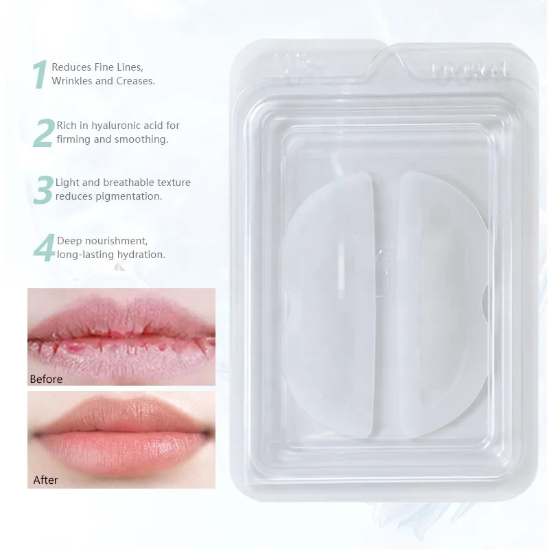 Wholesale Lip Mask Microneedle Patch Hyaluronic Acid 1800 Dissolving Microdarts Lip Filler Repair Care Sticker for Lip Plumping