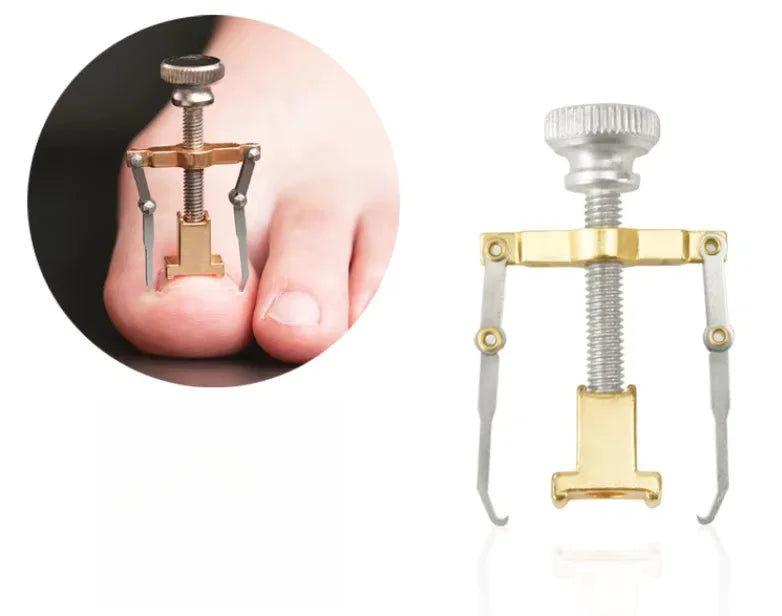 Toenails Correction Nail Fixer Care Tools File Elastic Patch Straightening Clip Brace Corrector Wire Fixer Set
