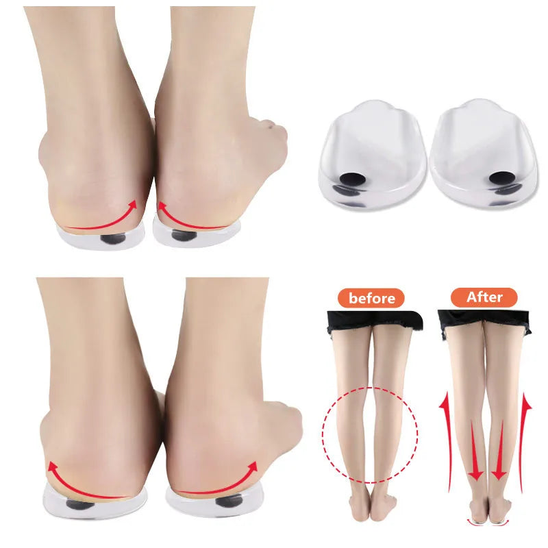 Silicone Gel Orthotic Heel Pad Comfort Insoles for Leg Orthopedic Varus Correction Foot Care Insert Insoles with Pain Relief