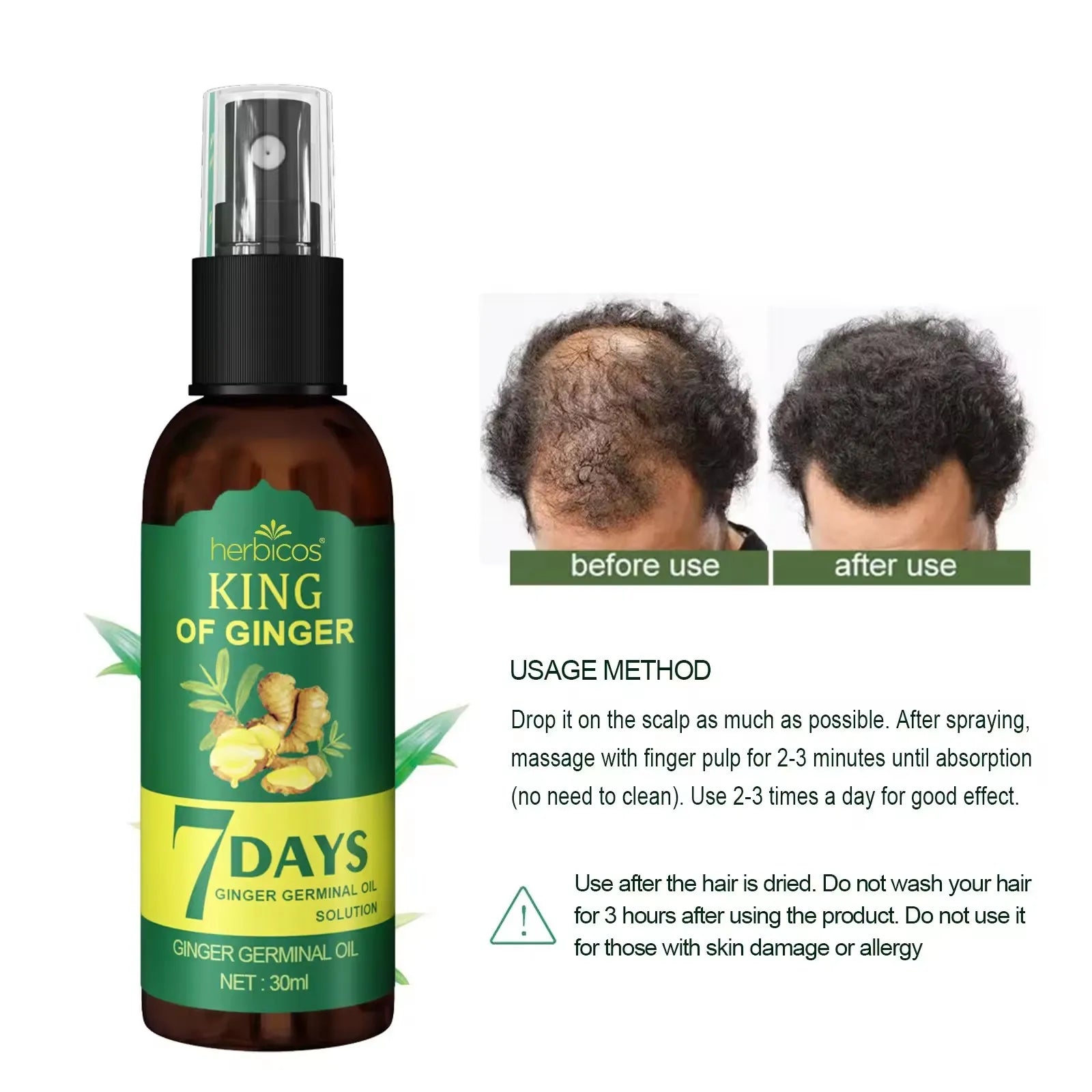 Herbicos 30ml 50ml Hair Care Treatment Anti Hair Loss 7 Days Ginger Germinal Oil Ginger Hair Growth Spray