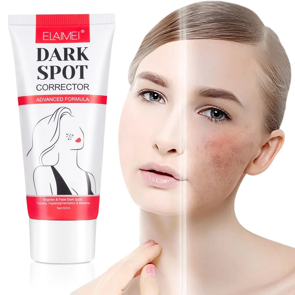 ELAIMEI 60ml Face Care Dark Spot Cream Remove Hyperpigmentation Melasma Fade Herbal Whitening Anti Freckle Cream