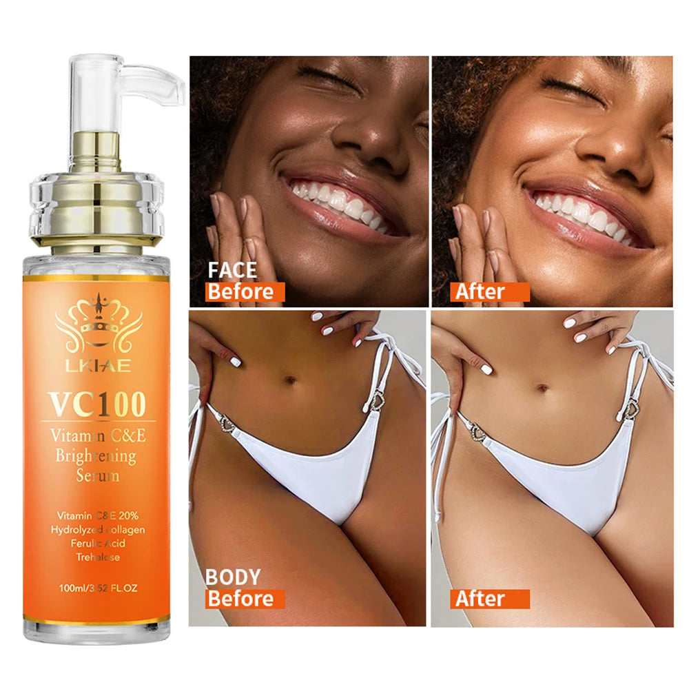 LKIAE Skin Care Serum 20% Vitamine c & Vitamin E Pigmentation Removal Whitening Face Vitamin c Serum