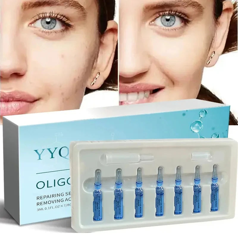 OEM/ODM Best Face Serum  Private Label Factory Customized Oligopeptides Repair Acne Serum Skin Care Serum Ampoules Brightening