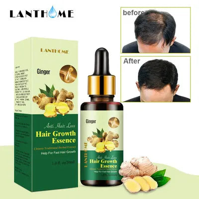 Wholesale Hair Care Anti Loss Pure Natural Hair Growth Ginger Oil 30ml
