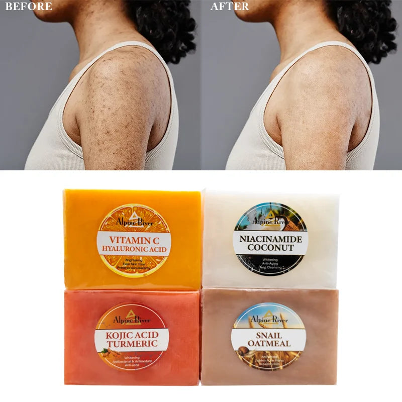 Natural Organic Skin Care Goat Milk Soap Skin Whitening and Exfoliating Glycerin Soap Handmade Rice Soap for Women