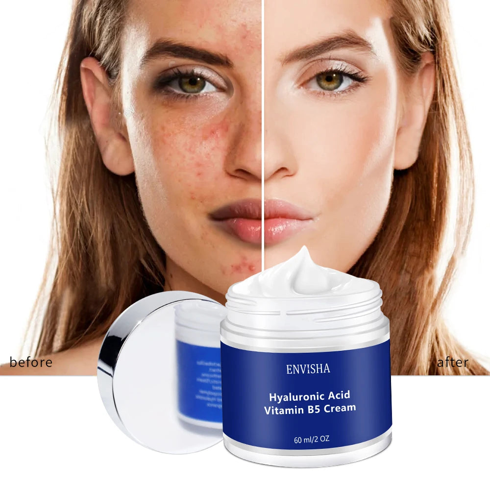 Natural Hyaluronic Acid Nourishing Moisturizer Vitamin B5 Face Day and Night Anti Wrinkle Cream