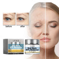 OUHOE Snail Mucin Moisturizer Refreshening Nourishing Softness Restoring Dark Spot Scar Removing Fine Line Minimizing Face Cream