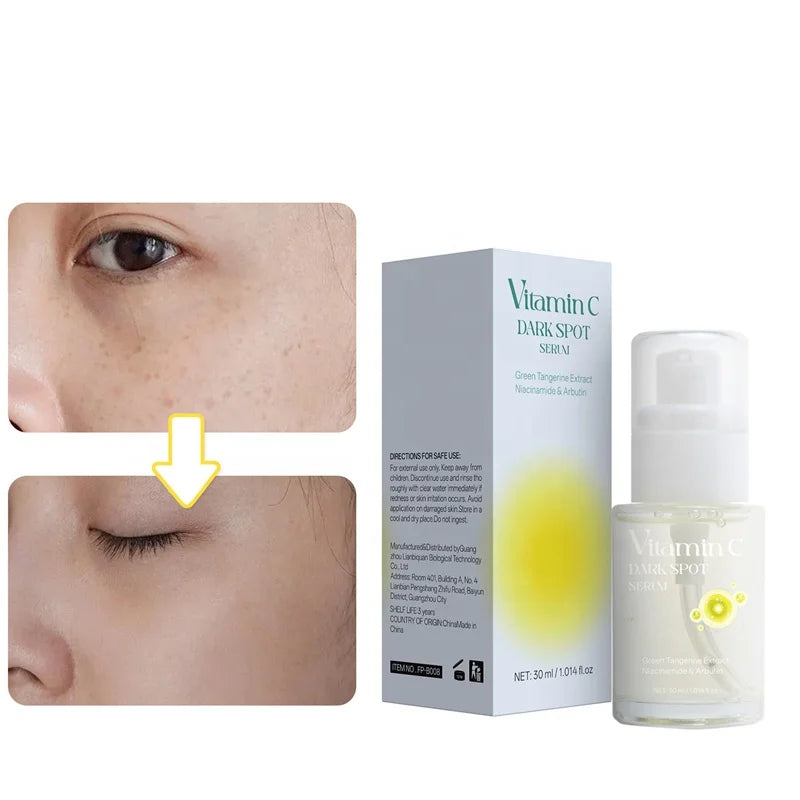 Lanthome Vitamin c Dark Spot Serum Moisturizing Skin Tone Brightening Pigmentation Inhibiting Dark Spot Correcting Serum No logo