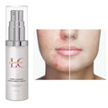 Private Label OEM Natural Vegan Organic Whitening Blackhead Cystic Dark Spot Acne Scar Anti Acne Face Cream for Pimples