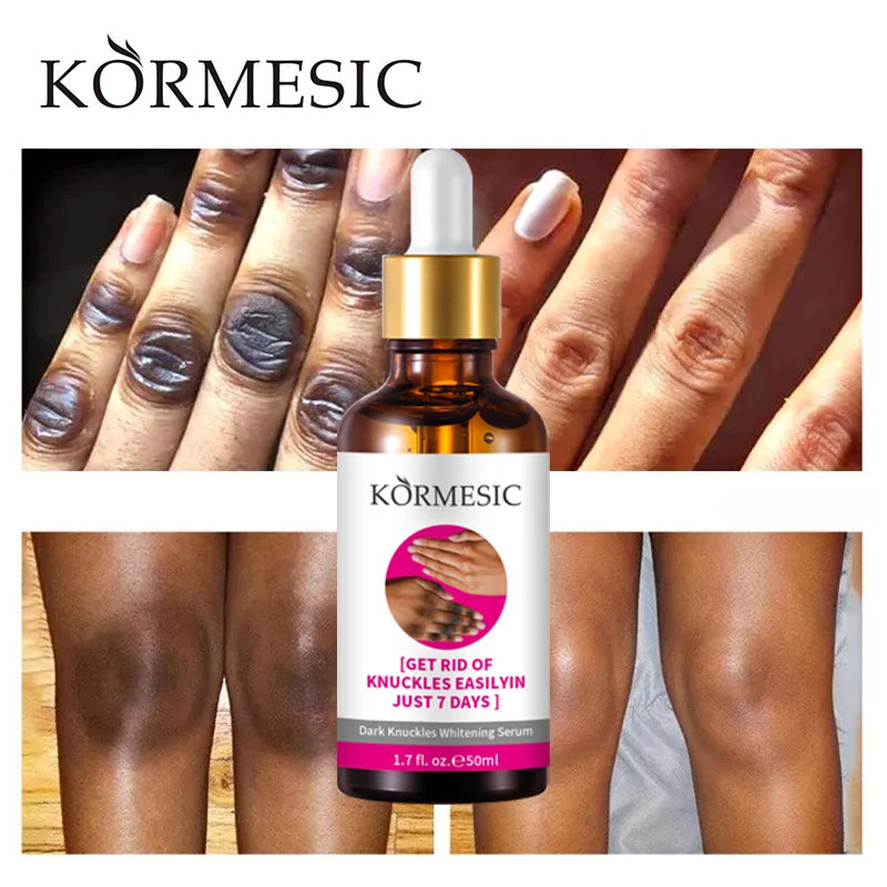 OEM Elbow Knee Fast Dark Knuckles Remover 7 Days Dark Knuckles Whitening Moisturizing  Serum