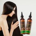 Private Label Natural Organic Anti-Dandruff Nourishing Hair Regrowth Treatment Scalp Care Massage Hair Scalp Oil with Castor Oil