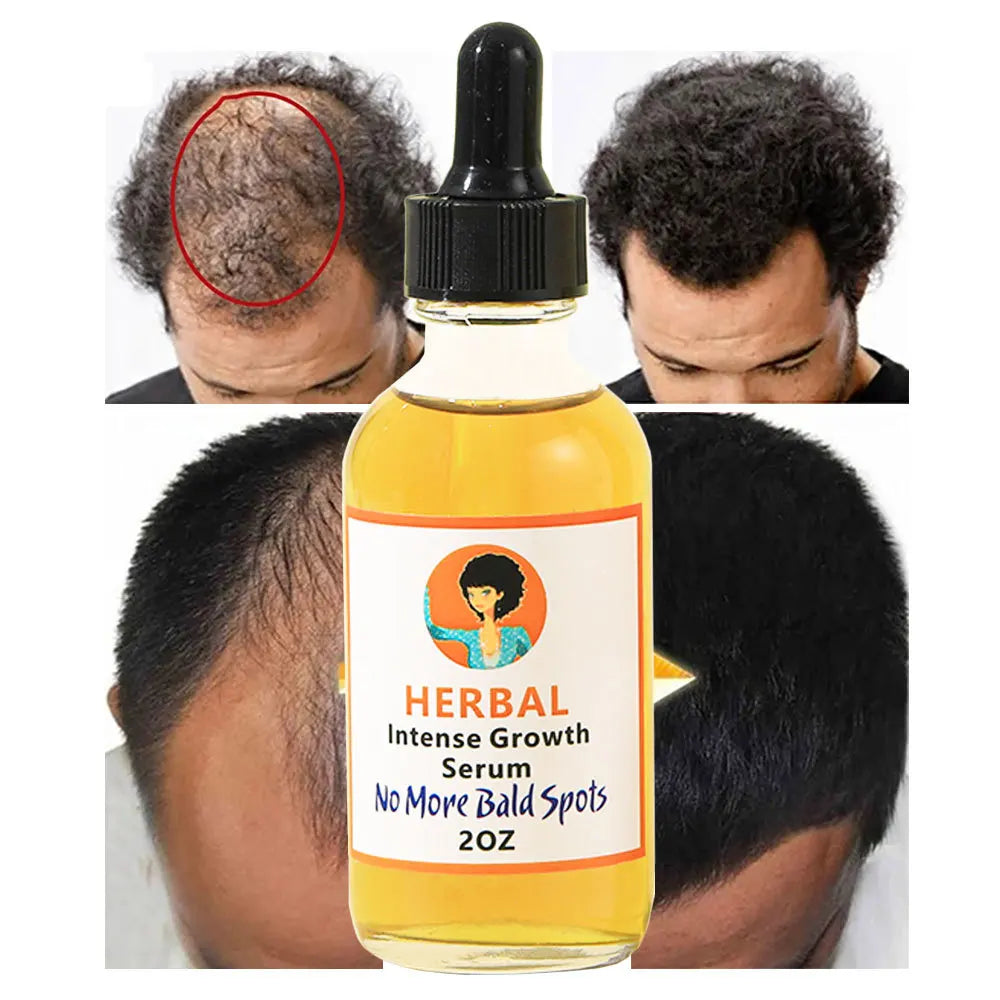Nutritious Hair Growth Oil Serum for Scalp Care Essential Hair Care Liquid for Essence Beauty & Personal Care Product