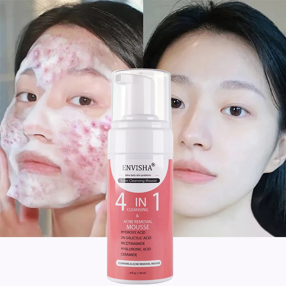 Private Label 4 in 1 Exfoliating Lightening Men Women Oily Skin Face Wash Acne Treatment Hydrating Deep Cleansing Foam Mousse