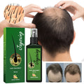 Jaysuing Hair Growth Spray Nourishing Root Hair Thick Growth Liquid Anti-fall Hair-fixing Spray