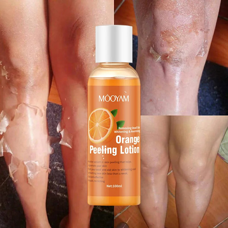 Orange Body Lotion with Gentle Exfoliating Gel Peeling Oil and Peeling Lotion for Beauty & Personal Care
