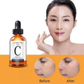 100 % Pure Wrinkle Face Vitamin c Serum Skin Whitening Brightening Moisture Natural Timeless 20% Vitamin c Serum Organic Natural