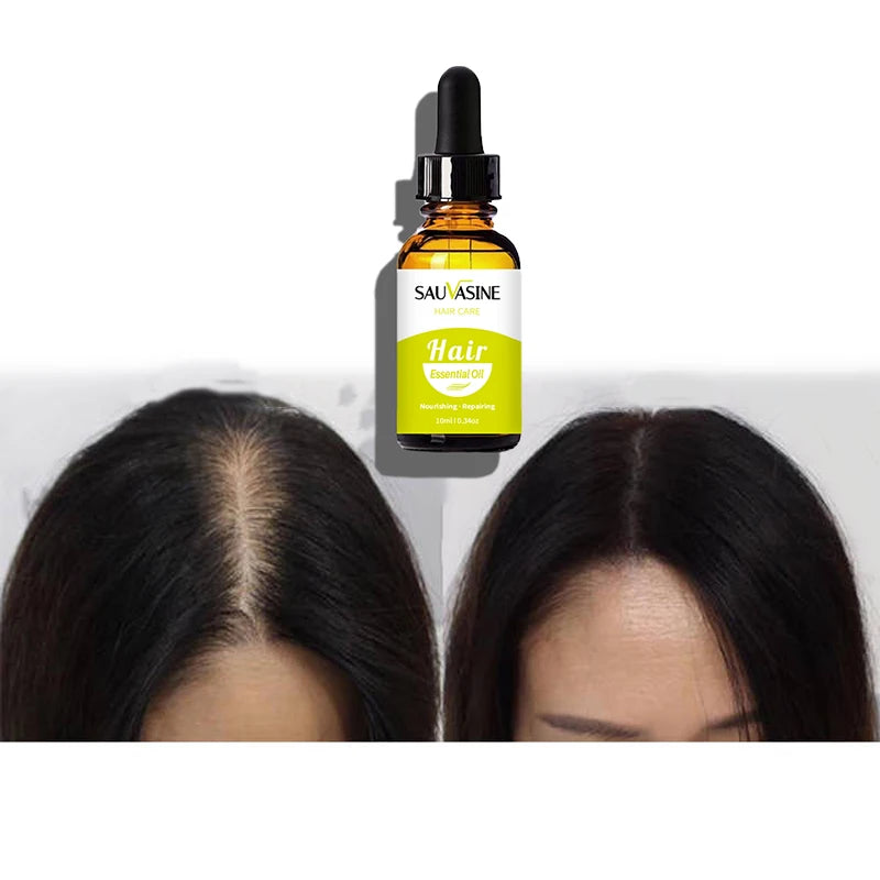 Natural Organic Plant Ingredients Stop Hair Loss Anti Hair Loss Argan Oil Hair Growth Oil for Black Women Men Private Label