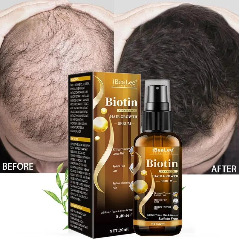 Private Label IBeaLee Anti-Loss Biotin Hair Growth Serum Spray for Women and Men Beard Growth Serum