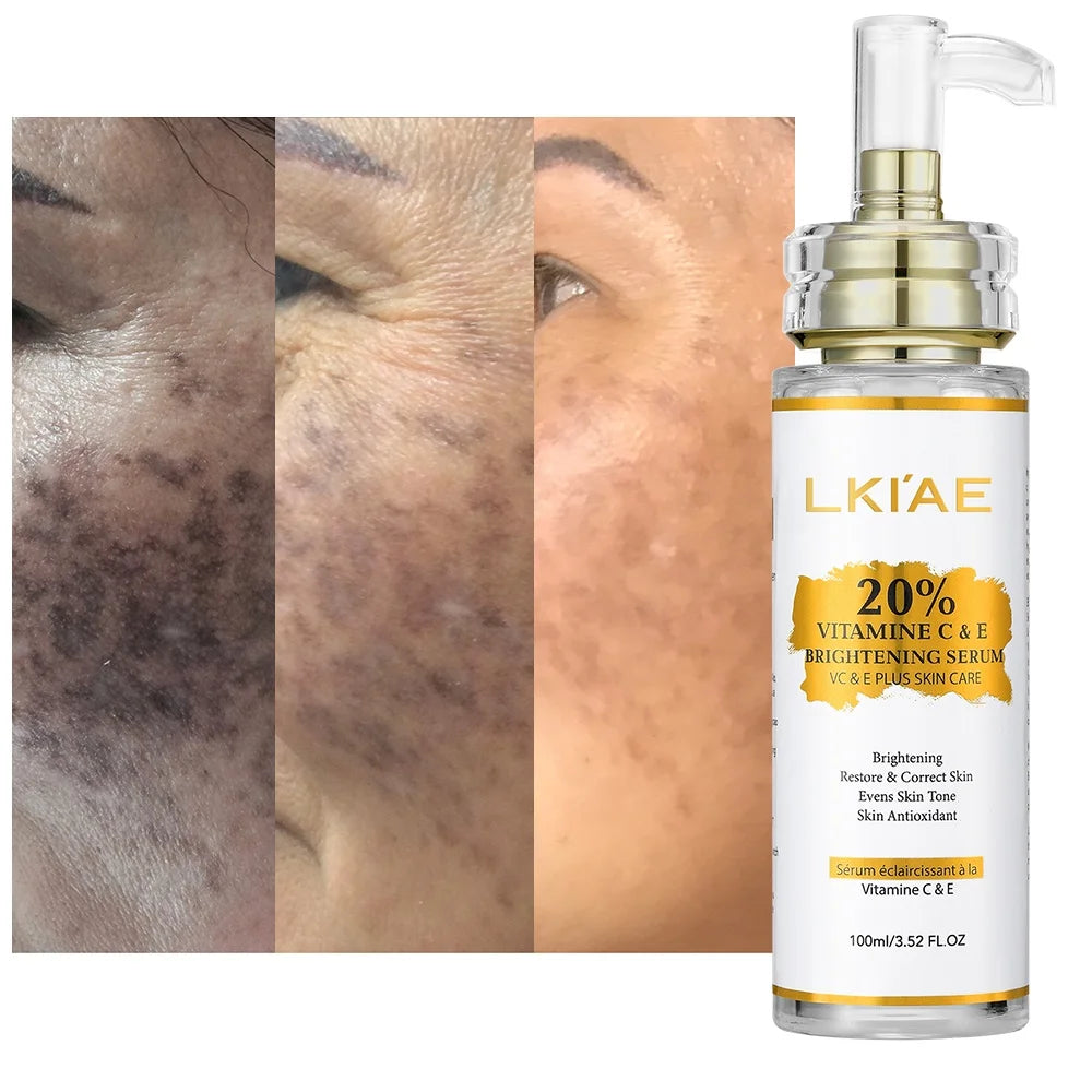 LKIAE Private Label Organic Cosmetics Vitamin C&E Peau Noire Whitening Anti Aging Facial Serum for Glowing Skin