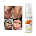 Private Label Turmeric Strong Lightening Facial Toner Moisturizing Whitening Brightening Acne Treatment Turmeric Face Toner