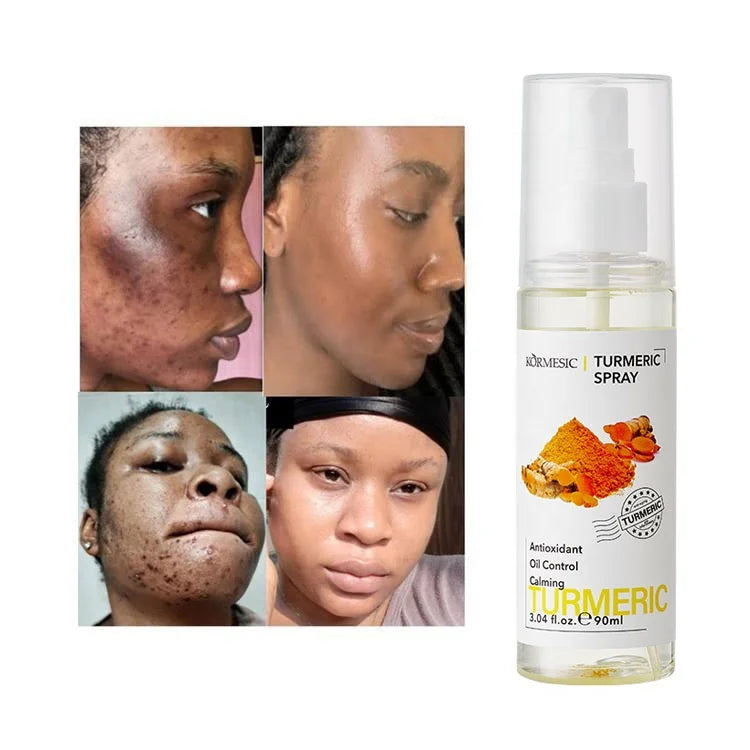 Private Label Turmeric Strong Lightening Facial Toner Moisturizing Whitening Brightening Acne Treatment Turmeric Face Toner