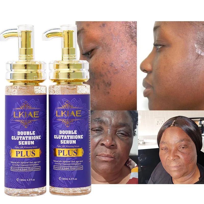 All in 1 Vegan Essence Niacinamide Vitamin C Retinol 24K Gold Brightening Whitening Skin Care Face Serum