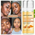 New Organic Vegan Vitamin C Spray Witch Hazel Face Toner for Oily Skin Lightening Anti-Aging Pimples