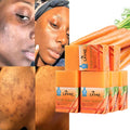 Rebrand Whitening Carrots Cleanser Soap for Moisturizing Whitening Hyperpigmentation Carrot Complexion Soaps