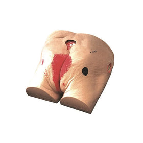 Advanced Decubitus Ulcer Care Simulator Model Decubitus Wound Care Model