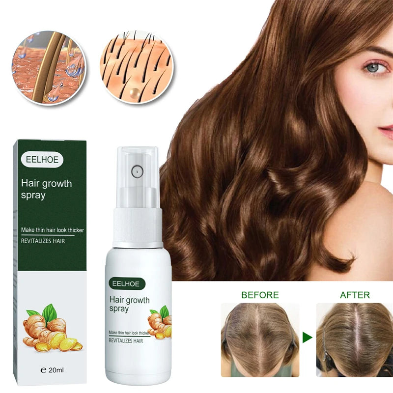 EELHOE 20ml Angelica Black Sesame Ginger Hair Growth Spray Anti Loss Alopecia Areata Seborrheic Alopecia Hair Serum for Growing