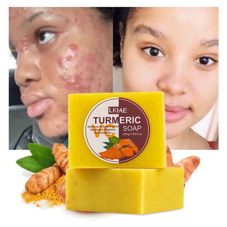 Wholesale 100% Natural Ginger Turmeric Toilet Soap Whitening Body Handmade Acne Remover All Skin Types